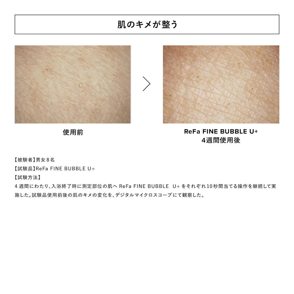 [Salon-Grade Skincare] ReFa FINE BUBBLE U / U+ Micro-Nano Bubble Shower Head | Deep Pore Cleansing, Skin Hydration Shield & Luxurious Shower Experience