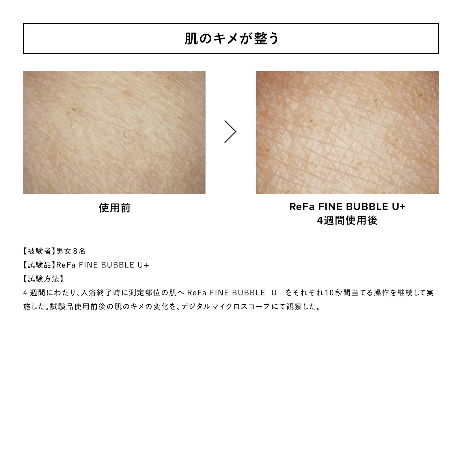 [Salon-Grade Skincare] ReFa FINE BUBBLE U / U+ Micro-Nano Bubble Shower Head | Deep Pore Cleansing, Skin Hydration Shield & Luxurious Shower Experience